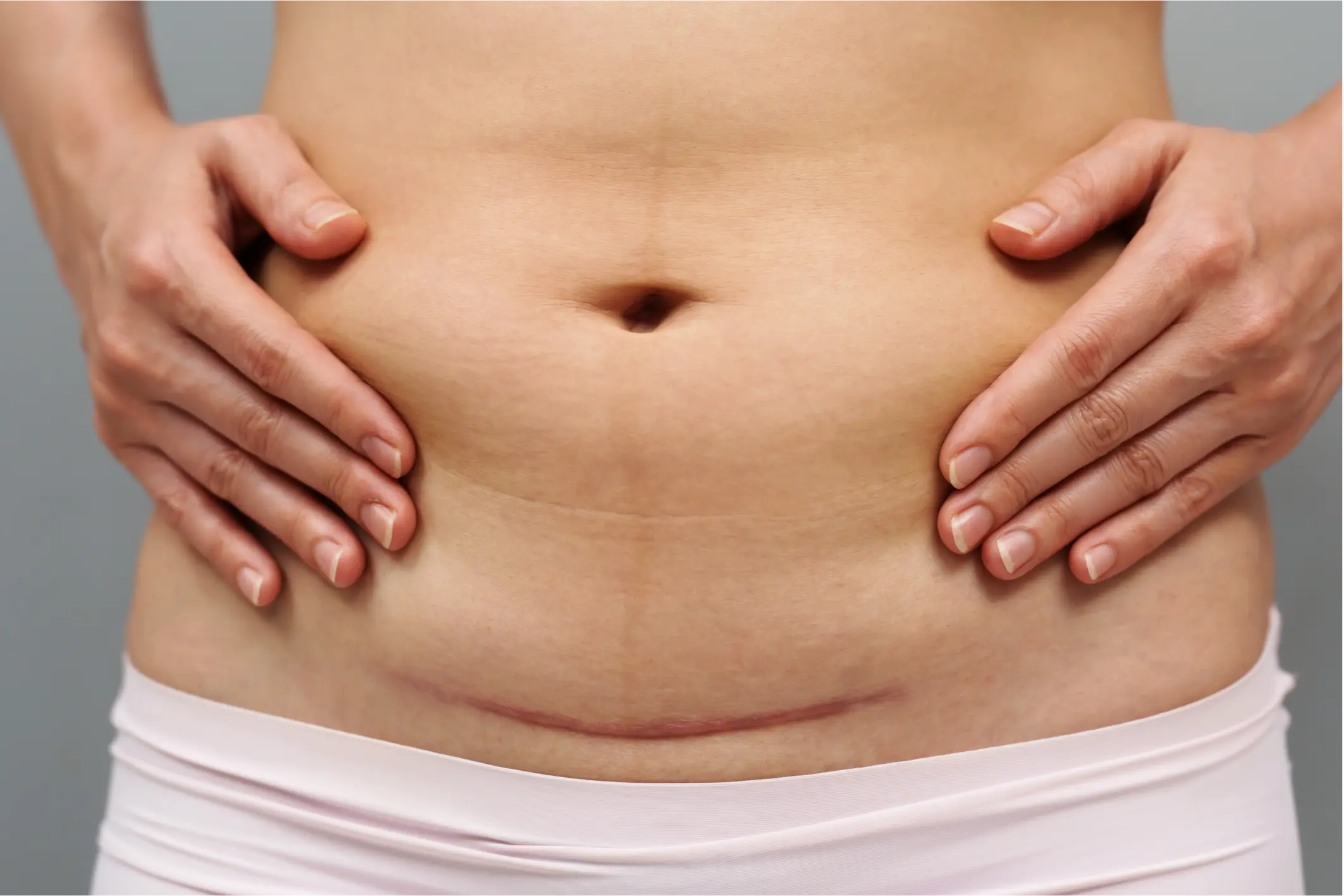 ¿Tienes cicatrices que afectan tu confianza?