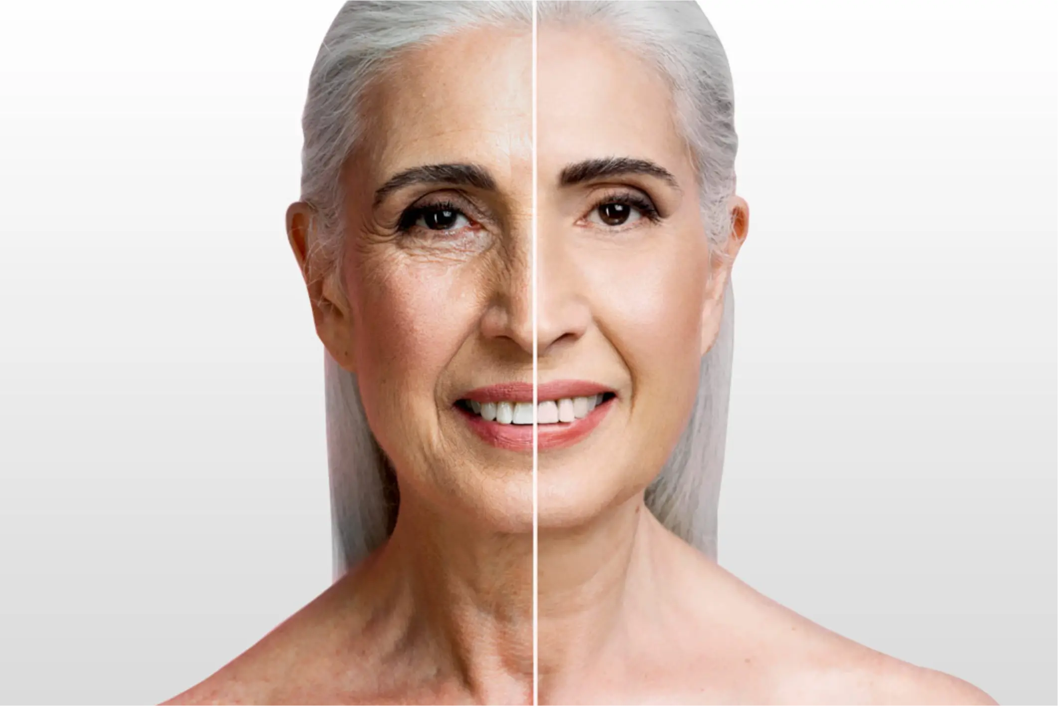 ¿Tienes arrugas profundas, cicatrices de acné o daño solar severo que afectan tu confianza?