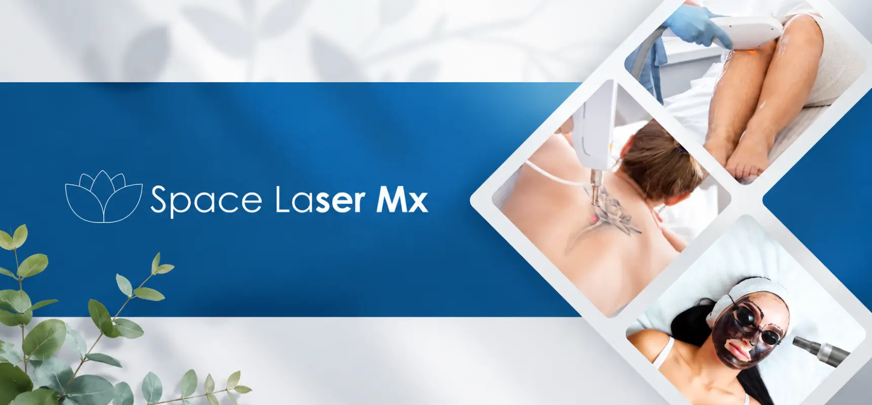 Space Laser Mx, sucursales en colonia roma y sur CDMX